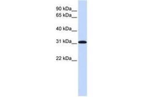 Image no. 1 for anti-Replication Protein A4, 30kDa (RPA4) (AA 180-229) antibody (ABIN6743785) (RPA4 antibody  (AA 180-229))
