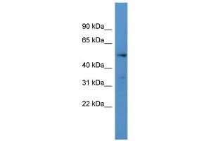 WB Suggested Anti-CYP24A1 Antibody Titration: 0. (CYP24A1 antibody  (C-Term))