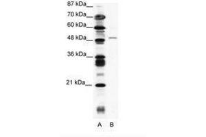 Image no. 1 for anti-Zinc Finger Protein 627 (ZNF627) (AA 44-93) antibody (ABIN202572)