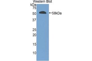 Western blot analysis of the recombinant protein. (GZMM antibody  (AA 19-251))