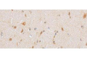 Immunohistochemistry of paraffin-embedded Mouse brain using TRIP4 Polyclonal Antibody at dilution of 1:50
