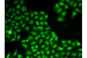 Immunofluorescence analysis of A549 cells using FEN1 antibody (ABIN5970521). (FEN1 antibody)