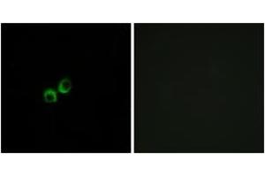 Immunofluorescence analysis of MCF7 cells, using TAS1R3 Antibody. (TAS1R3 antibody  (AA 326-375))