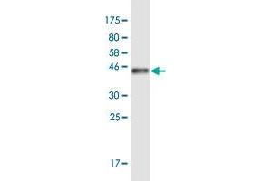 Western Blot detection against Immunogen (44. (SCP2D1 antibody  (AA 1-156))