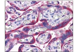 Human Placenta: Formalin-Fixed, Paraffin-Embedded (FFPE) (PAPPA2 antibody  (N-Term))