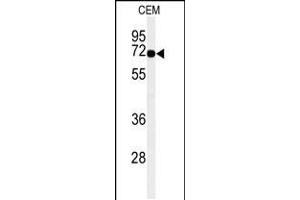 Western blot analysis of MFSD6 Antibody in CEM cell line lysates (35ug/lane) (MFSD6 antibody  (C-Term))