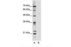 Image no. 1 for anti-Transcription Factor EB (TFEB) (C-Term) antibody (ABIN202620) (TFEB antibody  (C-Term))