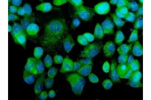 IF analysis of MEKK2/MAP3K2 using anti-MEKK2/MAP3K2 antibody (ABIN7599314). (MAP3K2 antibody  (AA 1-364))