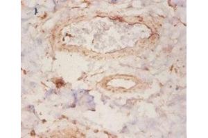 Immunohistochemistry of paraffin-embedded human mammary gland tissue using ABIN7167903 at dilution of 1:50 (ARHGDIA antibody  (AA 2-204))
