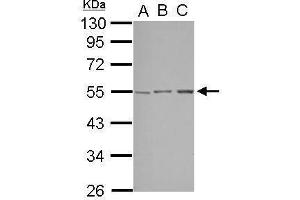 WB Image Sample (30 ug of whole cell lysate) A: A549 B: HepG2 C: HCT116 10% SDS PAGE antibody diluted at 1:1000 (STK38L antibody)