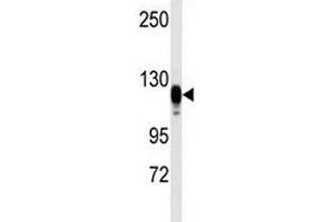 Western blot analysis of EGF Receptor antibody and kidney heart tissue lysate (EGFR antibody  (AA 1048-1077))