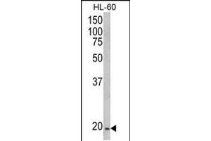 Western blot analysis of NDUFS4 Antibody in HL-60 cell line lysates (35ug/lane) (NDUFS4 antibody  (C-Term))
