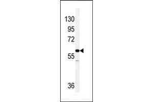 Western blot analysis of Vimentin antibody in NCI-H460 cell line lysates (35ug/lane). (Vimentin antibody  (C-Term))