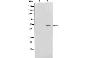 Western blot analysis on COLO205 cell lysate using AP-2 Antibody,The lane on the left is treated with the antigen-specific peptide.