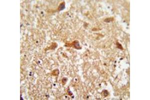 Immunohistochemistry analysis in human brain tissue (Formalin-fixed, Paraffin-embedded) using PIGX  Antibody  (N-term), followed by peroxidase conjugated secondary antibody and DAB staining. (PIGX antibody  (N-Term))