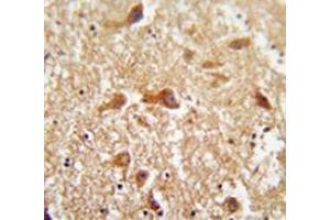 Immunohistochemistry analysis in human brain tissue (Formalin-fixed, Paraffin-embedded) using PIGX  Antibody  (N-term), followed by peroxidase conjugated secondary antibody and DAB staining.