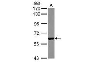 Image no. 2 for anti-Carboxylesterase 2 (CES2) (AA 310-522) antibody (ABIN1497478) (CES2 antibody  (AA 310-522))