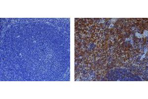 Immunohistochemical staining of endogenous mouse Caspase-1 in mouse spleen using anti-Caspase-1 (p20) (mouse), mAb (Casper-1)  (1:500) by standard immunohistochemistry (antigen retrieval performed with sodium citrate).