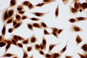 Anti-MCM7 antibody, ICC ICC: HELA Cell (MCM7 antibody  (C-Term))