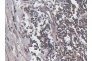 DAB staining on IHC-P; Samples: Human Lymph node Tissue (Perforin 1 antibody  (AA 32-316))