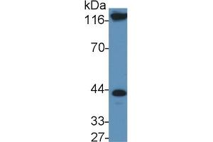 Detection of IL11Ra in Rat Serum using Polyclonal Antibody to Interleukin 11 Receptor Alpha (IL11Ra)
