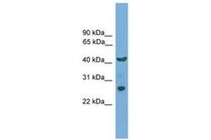Image no. 1 for anti-Transmembrane Protein 176A (TMEM176A) (AA 35-84) antibody (ABIN6745595) (TMEM176A antibody  (AA 35-84))