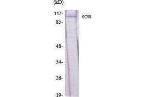 Western Blot (WB) analysis of specific cells using GCN5 Polyclonal Antibody. (KAT2A antibody  (C-Term))
