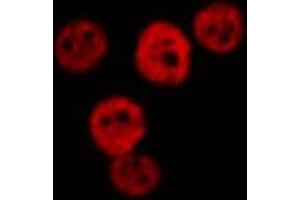ABIN6277019 staining  Hela cells by IF/ICC.