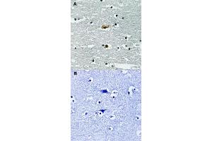 Immunohistochemical staining of human brain tissue by STK39 (phospho S309) polyclonal antibody  without blocking peptide (A) or preincubated with blocking peptide (B). (STK39 antibody  (pSer309))