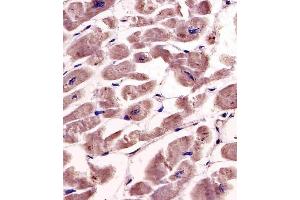 (ABIN391346 and ABIN2841367) staining SPHK1 in human heart tissue sections by Immunohistochemistry (IHC-P - paraformaldehyde-fixed, paraffin-embedded sections). (SPHK1 antibody  (AA 286-315))