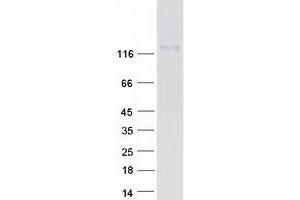 Validation with Western Blot (MKL2 Protein (Myc-DYKDDDDK Tag))