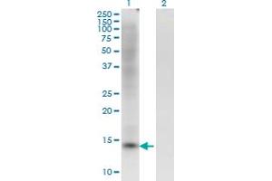 Western Blot analysis of ZBTB16 expression in transfected 293T cell line by ZBTB16 monoclonal antibody (M02), clone 1F10. (ZBTB16 antibody  (AA 381-480))