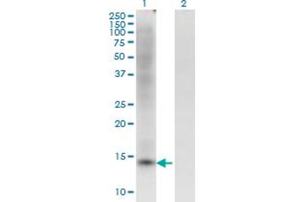 ZBTB16 antibody  (AA 381-480)