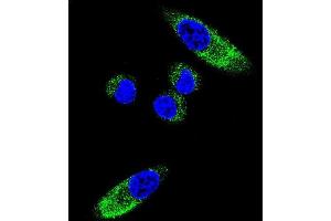 Confocal immunofluorescent analysis of CYP1A1 Antibody (Center) (ABIN392527 and ABIN2842082) with MDA-M cell followed by Alexa Fluor 488-conjugated goat anti-rabbit lgG (green). (CYP1A1 antibody  (AA 252-280))