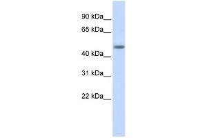 WB Suggested Anti-LASS5 Antibody Titration:  0. (LASS5 antibody  (N-Term))