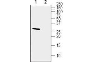 Western blot analysis of mouse brain lysate: - 1. (KCNIP2 antibody  (Cytosolic))