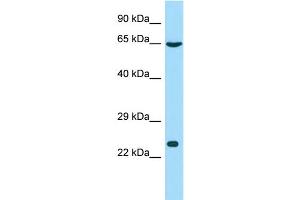 Host: Rabbit Target Name: GSTCD Sample Type: Hela Whole cell lysates Antibody Dilution: 1. (GSTCD antibody  (N-Term))