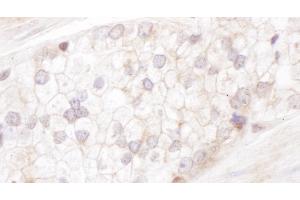 anti-Desmoplakin (DSP) (AA 1900-1950) antibody
