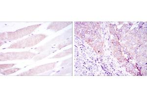 Immunohistochemical analysis of paraffin-embedded muscle tissues (left) and kidney cancer tissues (right) using BMPR2 mouse mAb with DAB staining. (BMPR2 antibody)