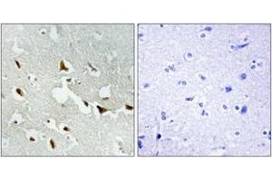Immunohistochemistry analysis of paraffin-embedded human brain tissue, using IRS-1 (Ab-636) Antibody. (IRS1 antibody  (AA 603-652))