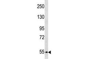 PCSK4 antibody western blot analysis in SK-BR-3 lysate. (PCSK4 antibody  (AA 168-196))