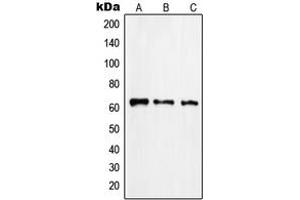 Western blot analysis of Rabaptin 5 beta expression in Jurkat (A), HuvEc (B), human pancreas (C) whole cell lysates. (RABEP2 antibody  (Center))