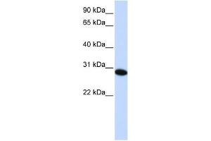 PHF19 antibody used at 0.
