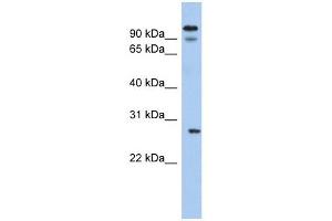 VDAC3 antibody used at 1 ug/ml to detect target protein. (VDAC3 antibody  (N-Term))