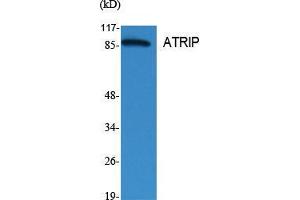 Western Blot (WB) analysis of specific cells using ATRIP Polyclonal Antibody. (ATRIP antibody  (Tyr783))
