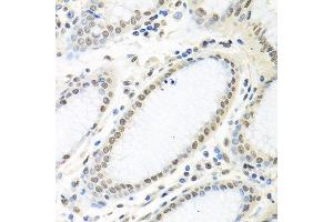 Immunohistochemistry (Paraffin-embedded Sections) (IHC (p)) image for anti-ELAV (Embryonic Lethal, Abnormal Vision, Drosophila)-Like 1 (Hu Antigen R) (ELAVL1) (AA 1-100) antibody (ABIN6140112)