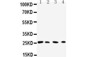 Western Blotting (WB) image for anti-RAB3C, Member RAS Oncogene Family (Rab3c) (AA 204-217), (C-Term) antibody (ABIN3042555) (Rab3c antibody  (C-Term))