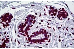 Human Breast: Formalin-Fixed, Paraffin-Embedded (FFPE) (EN1 antibody  (AA 266-392))