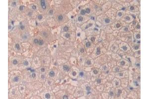 Detection of DHH in Human Liver Tissue using Polyclonal Antibody to Hedgehog Homolog, Desert (DHH) (desert Hedgehog antibody  (AA 241-383))