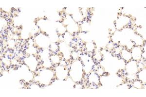 Detection of GAS6 in Mouse Lung Tissue using Polyclonal Antibody to Growth Arrest Specific Protein 6 (GAS6) (GAS6 antibody  (AA 483-646))